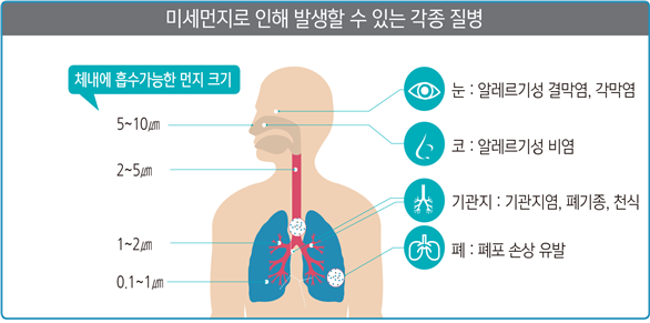 미세먼지로 인해 발생할 수 있는 각종 질병